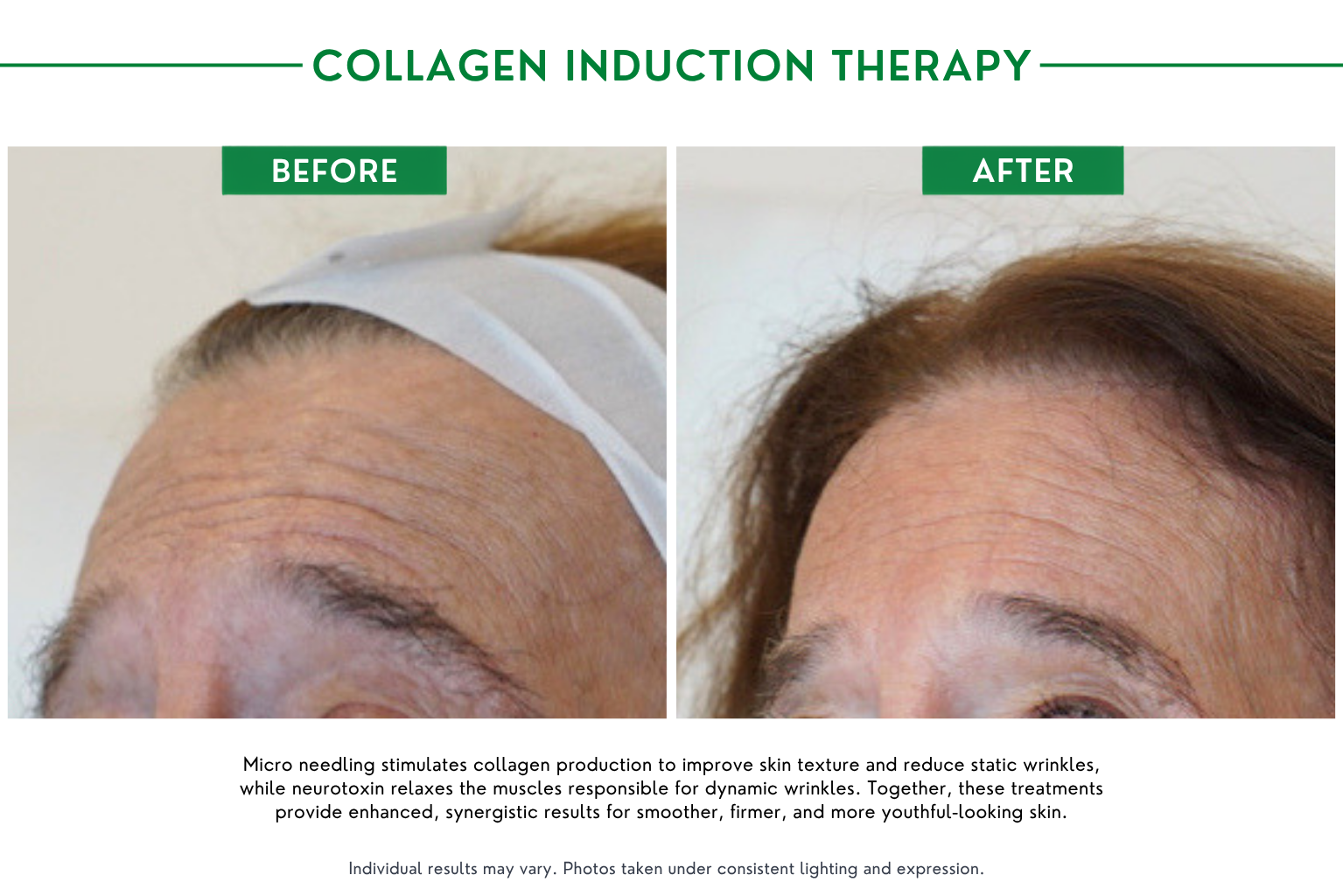 Collagen B_A (1)