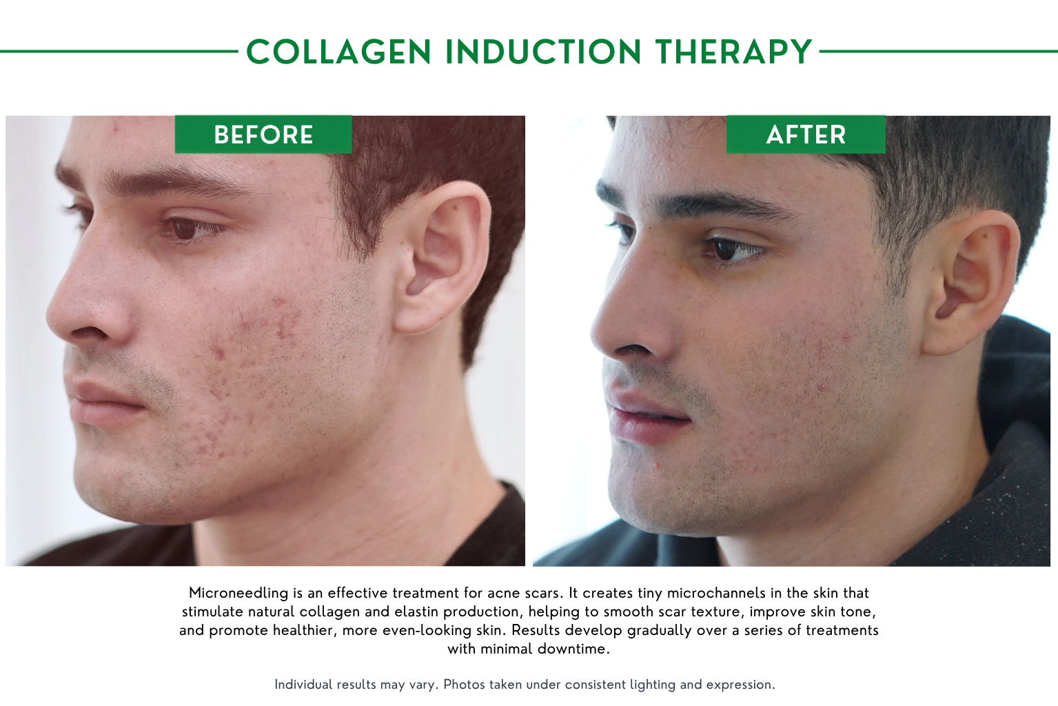 Collagen B_A (2)