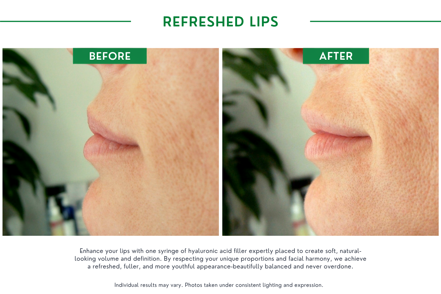 Refresh lips B_A (13)