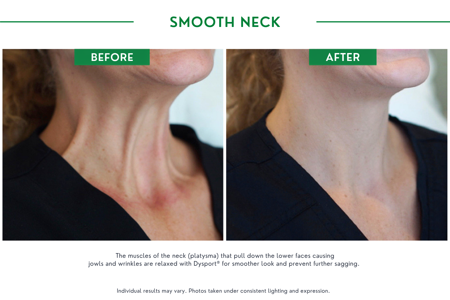 Smooth neck B_A (3)