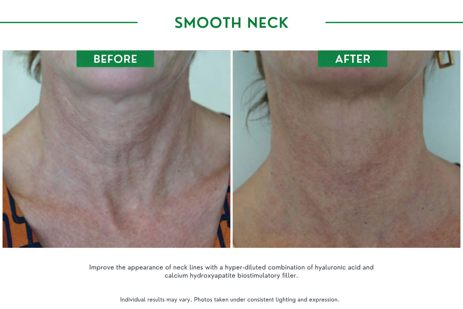 Smooth neck B_A (4)