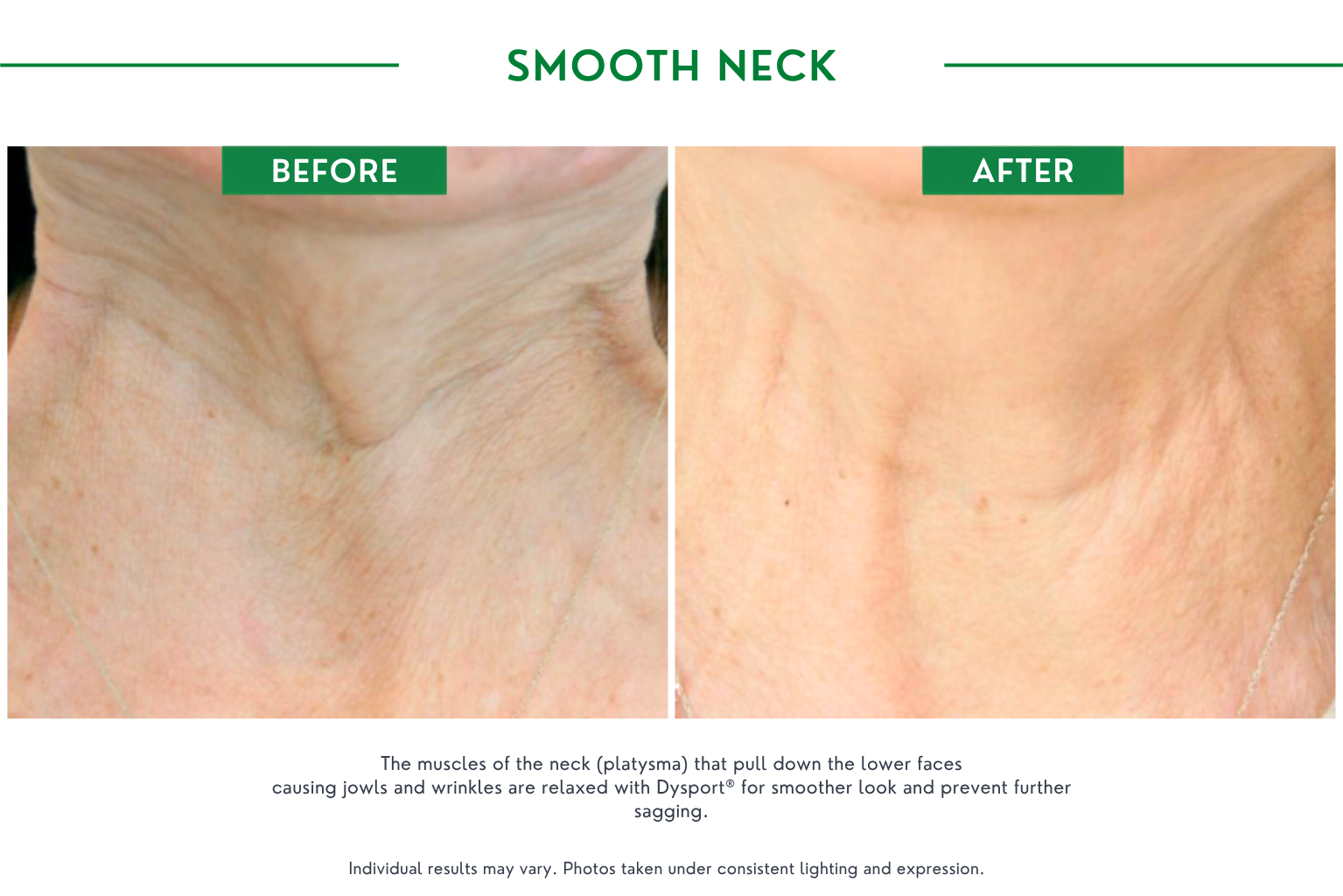 Smooth neck B_A (5)