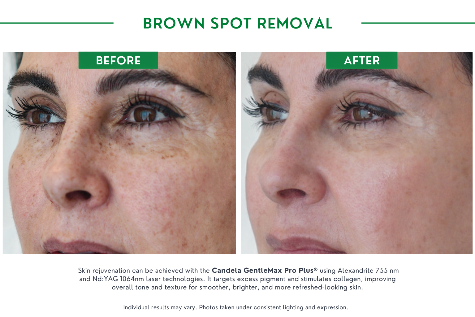 brown spot B_A (5)