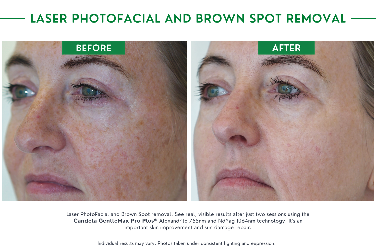 brown spot B_A (8)